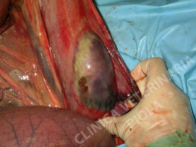 Necrosi e perforazione ileo da distensione